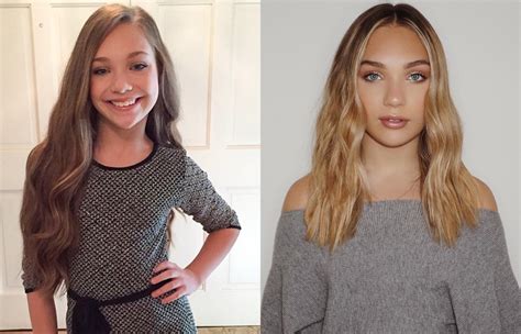 Maddie ziegler nose job. Things To Know About Maddie ziegler nose job. 